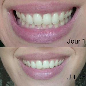 avis dentifrice nuskin